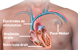 Illust: Emplacement d'un (...), 89.1 ko, 257x167